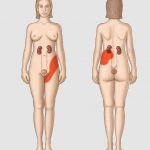 Uroblog_colica-renale