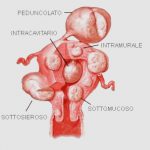 uroblog_fattore_uterino