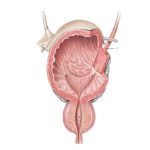 uroblog_uretere_2