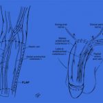 Falcone_Uroblog_amputazione