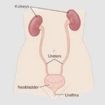 uroblog_cacciamani