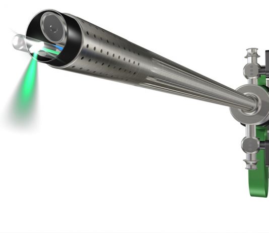 Chirurgia dell’IPB: standard o laser?
