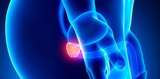 Dieta e Prostatite: riflessioni sulla possibile azione degli acidi grassi polinsaturi…