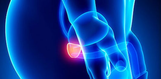 Dieta e Prostatite: riflessioni sulla possibile azione degli acidi grassi polinsaturi…