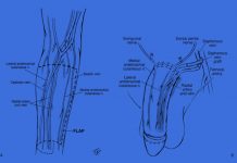 Ricostruzione in seguito ad amputazione del pene