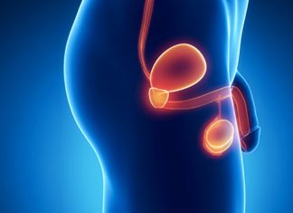 Nuove frontiere nel trattamento del tumore prostatico: La terapia focale