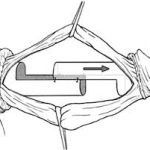 uroblog-2-immagine-2