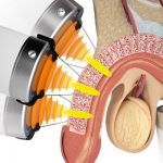 aaeaaqaaaaaaaagxaaaajdawogqzmzdhltm4nzqtngnmos05mzu5ltm1ogqyndyxyjhhza