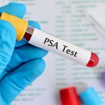 psa-test