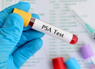 Esistono ancora dei meriti del PSA per la diagnosi di tumore alla prostata?