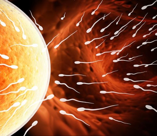 Inseminazione Intra-uterina