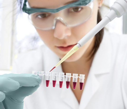 Come interpretare il risultato della ricerca della mutazione della Fibrosi Cistica