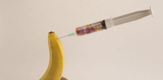 Associazione di onde d’urto (ESWT) e collagenasi (Xiapex) nel trattamento dell’induratio penis plastica con o senza disfunzione erettile associata.