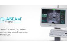 Il primo intervento automatizzato robotico per l’ipertrofia prostatica