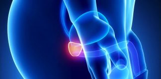 Nuove terapie per l’ipertrofia prostatica benigna